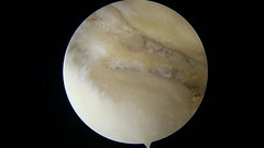 Inside knee