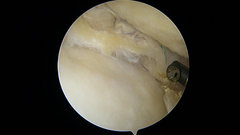 Inside knee